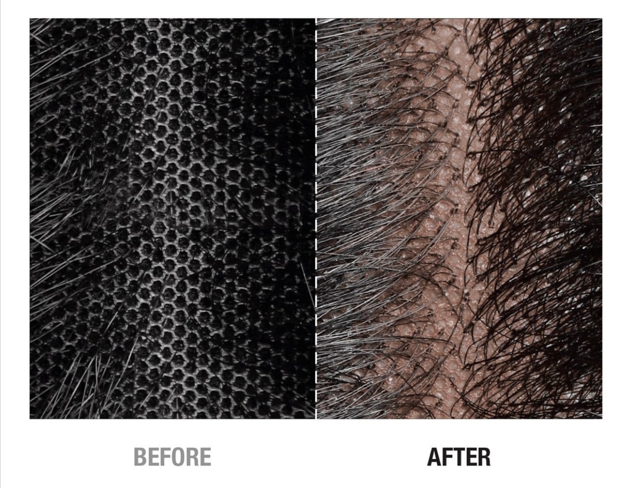 Knot Eraser for Synthetic and Human Wigs Knot Camouflage Protects Skin and Removes Knots Hides Lace Wig Knots Healer in Color Natural