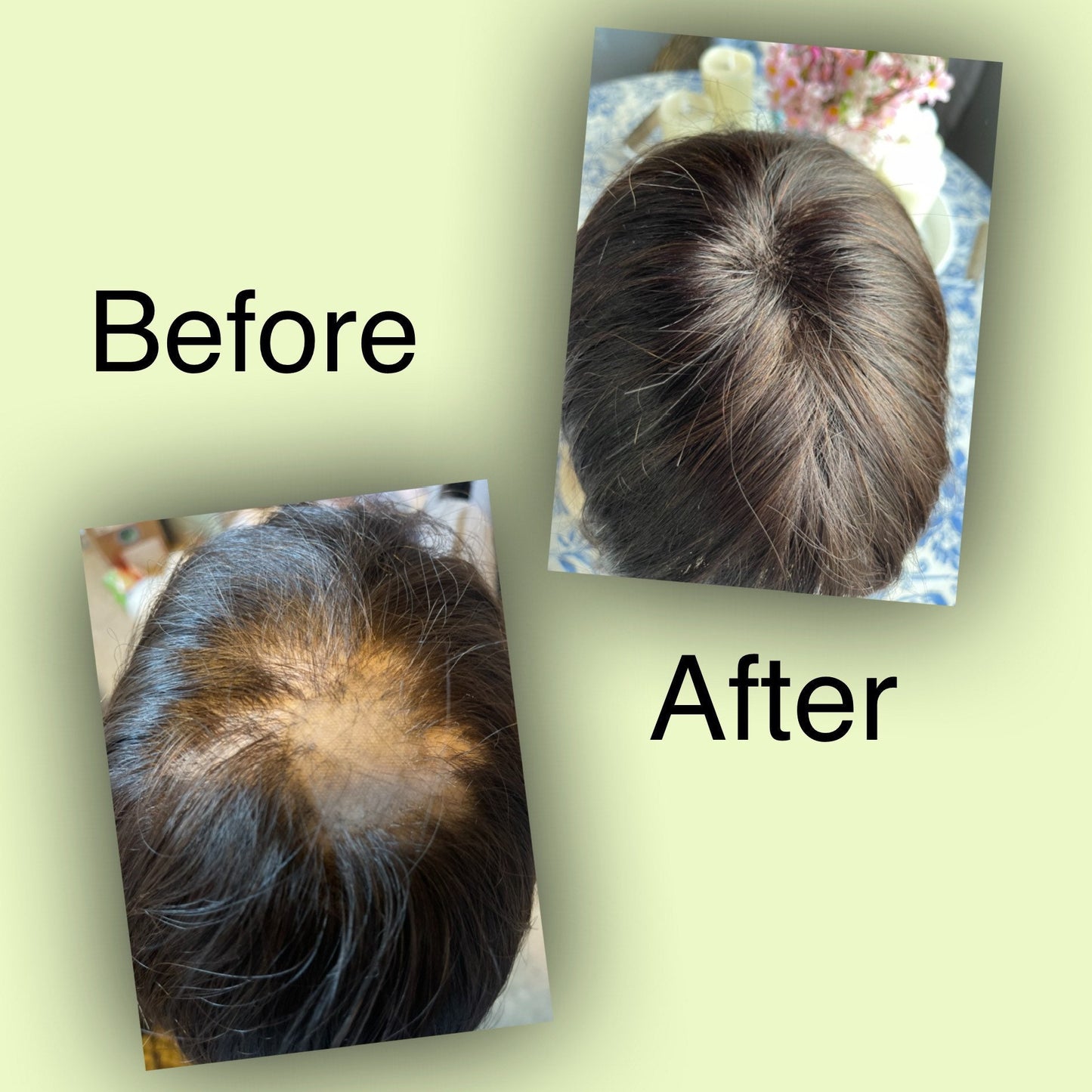 4 Hour Wig Ventilating Service And Repair Add Hair To Your Lace Closure