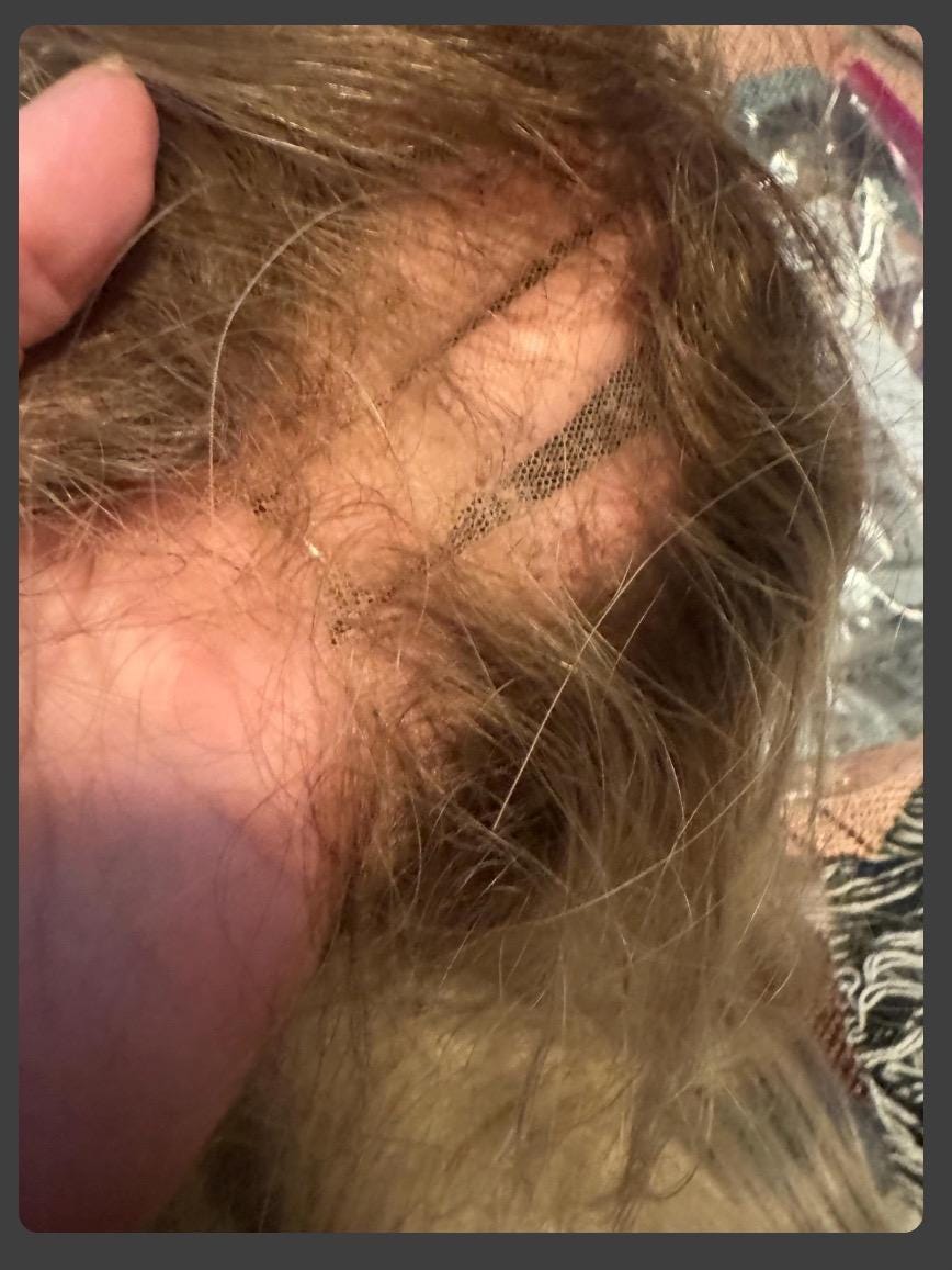 4 Hour Wig Ventilating Service And Repair Add Hair To Your Lace Closure